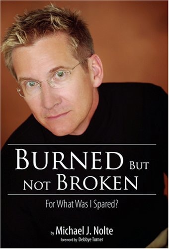 Burned But Not Broken: For What Was I Spared?